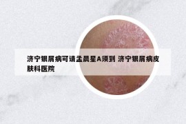 济宁银屑病可请孟晨星A须到 济宁银屑病皮肤科医院