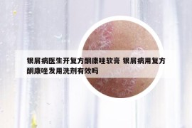 银屑病医生开复方酮康唑软膏 银屑病用复方酮康唑发用洗剂有效吗