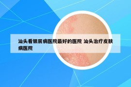 汕头看银屑病医院最好的医院 汕头治疗皮肤病医院