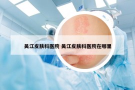 吴江皮肤科医院 吴江皮肤科医院在哪里