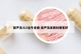 葫芦岛313治牛皮癣 葫芦岛皮肤科哪家好