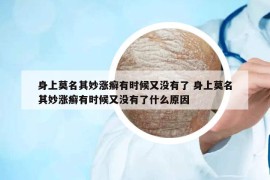 身上莫名其妙涨癣有时候又没有了 身上莫名其妙涨癣有时候又没有了什么原因