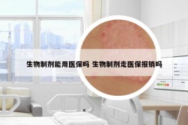 生物制剂能用医保吗 生物制剂走医保报销吗