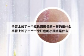 手臂上长了一个红色圆形像癣一样的是什么 手臂上长了一个一个红色的小圆点是什么