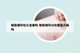 银屑病可吃火龙果吗 银屑病可以吃番茄火锅吗