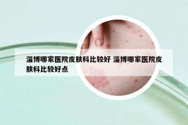 淄博哪家医院皮肤科比较好 淄博哪家医院皮肤科比较好点
