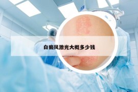 白癜风激光大概多少钱
