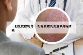 一扫光皮肤乳膏 一扫光皮肤乳膏治单纯疱疹吗