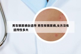 男生银屑病会遗传 男性有银屑病,女方没有 遗传性多大