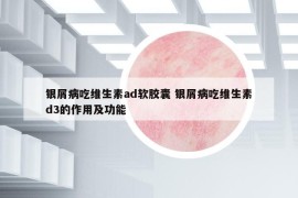 银屑病吃维生素ad软胶囊 银屑病吃维生素d3的作用及功能