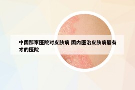 中国那家医院对皮肤病 国内医治皮肤病最有才的医院