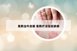 象数治牛皮癣 象数疗法治皮肤病