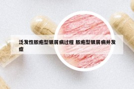 泛发性脓疱型银屑病过程 脓疱型银屑病并发症