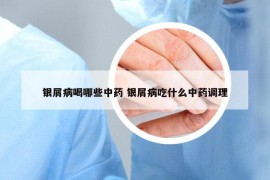 银屑病喝哪些中药 银屑病吃什么中药调理