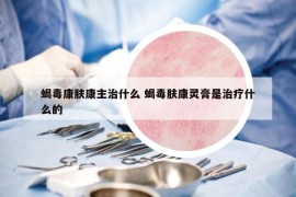 蝎毒康肤康主治什么 蝎毒肤康灵膏是治疗什么的