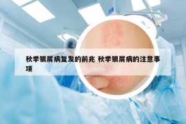 秋季银屑病复发的前兆 秋季银屑病的注意事项