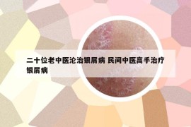二十位老中医沦治银屑病 民间中医高手治疗银屑病