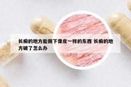 长癣的地方能撕下像皮一样的东西 长癣的地方破了怎么办