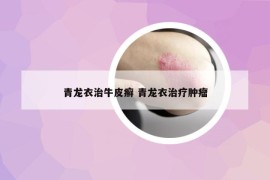 青龙衣治牛皮癣 青龙衣治疗肿瘤