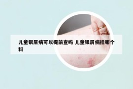 儿童银屑病可以提前查吗 儿童银屑病挂哪个科
