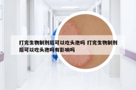 打完生物制剂后可以吃头孢吗 打完生物制剂后可以吃头孢吗有影响吗