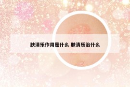 肤清乐作用是什么 肤清乐治什么