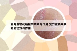 复方金银花颗粒的功效与作用 复方金钱草颗粒的功效与作用