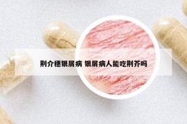 荆介穗银屑病 银屑病人能吃荆芥吗