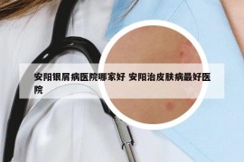 安阳银屑病医院哪家好 安阳治皮肤病最好医院