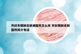 开封市朝鲜皮肤病医院怎么样 开封朝鲜皮肤医院简介电话