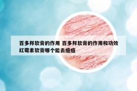 百多邦软膏的作用 百多邦软膏的作用和功效红霉素软膏哪个能去痘痘