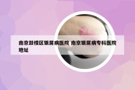 南京鼓楼区银屑病医院 南京银屑病专科医院地址