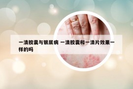 一清胶囊与银屑病 一清胶囊和一清片效果一样的吗