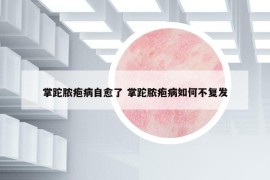掌跎脓疱病自愈了 掌跎脓疱病如何不复发
