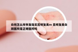 白班怎么样恢复指定昆明复美m 昆明复美白斑医院是正规医院吗