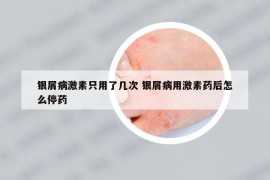 银屑病激素只用了几次 银屑病用激素药后怎么停药