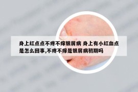 身上红点点不疼不痒银屑病 身上有小红血点是怎么回事,不疼不痒是银屑病初期吗