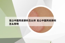 龙口中医院皮肤科怎么样 龙口中医院皮肤科怎么样呀