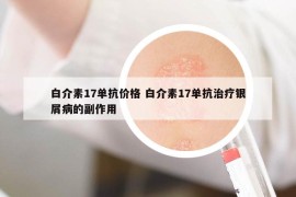 白介素17单抗价格 白介素17单抗治疗银屑病的副作用