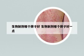 生物制剂哪个牌子好 生物制剂哪个牌子好一点