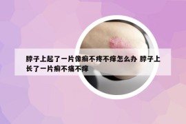 脖子上起了一片像癣不疼不痒怎么办 脖子上长了一片癣不痛不痒