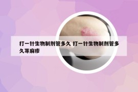 打一针生物制剂管多久 打一针生物制剂管多久荨麻疹