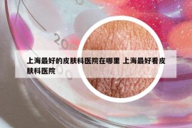 上海最好的皮肤科医院在哪里 上海最好看皮肤科医院