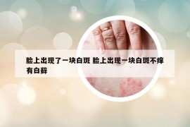 脸上出现了一块白斑 脸上出现一块白斑不痒有白藓