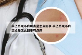 手上出现小白斑点是怎么回事 手上出现小白斑点是怎么回事有点痒