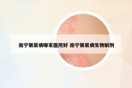 南宁银屑病哪家医院好 南宁银屑病生物制剂
