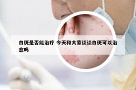 白斑是否能治疗 今天和大家谈谈白斑可以治愈吗