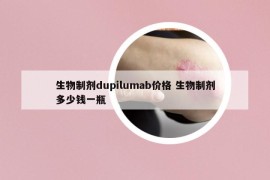 生物制剂dupilumab价格 生物制剂多少钱一瓶