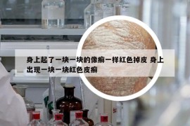 身上起了一块一块的像癣一样红色掉皮 身上出现一块一块红色皮癣