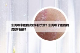东莞哪家医院皮肤科比较好 东莞哪个医院的皮肤科最好